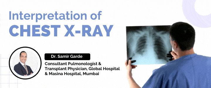 Interpretation of Chest X-ray