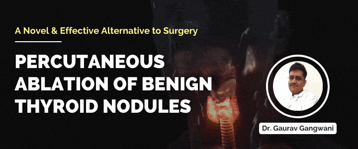 Percutaneous Ablation of Benign Thyroid Nodules: A Novel & Effective Alternative to Surgery
