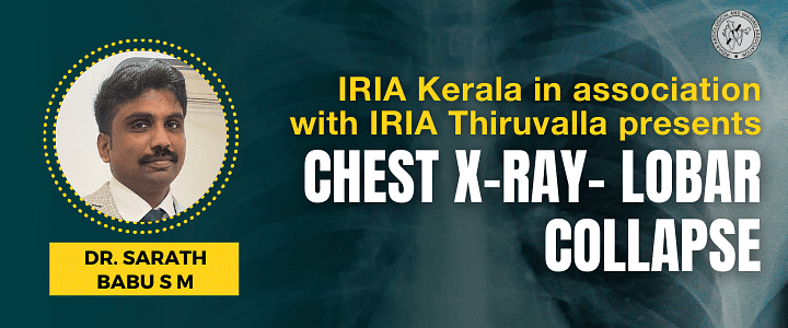 IRIA Kerala in association with IRIA Thiruvalla presents- Chest X-ray- Lobar Collapse
