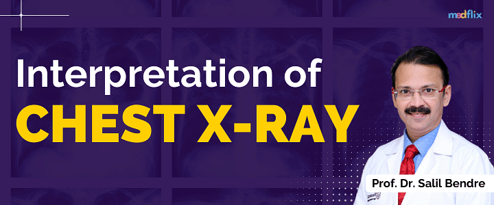 Interpretation of Chest X-ray