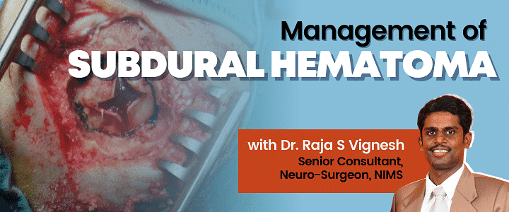 Management of Subdural Hematoma 