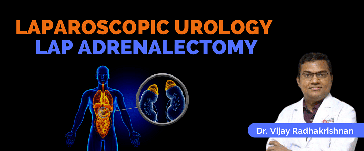 Laparoscopic Urology- Lap Adrenalectomy